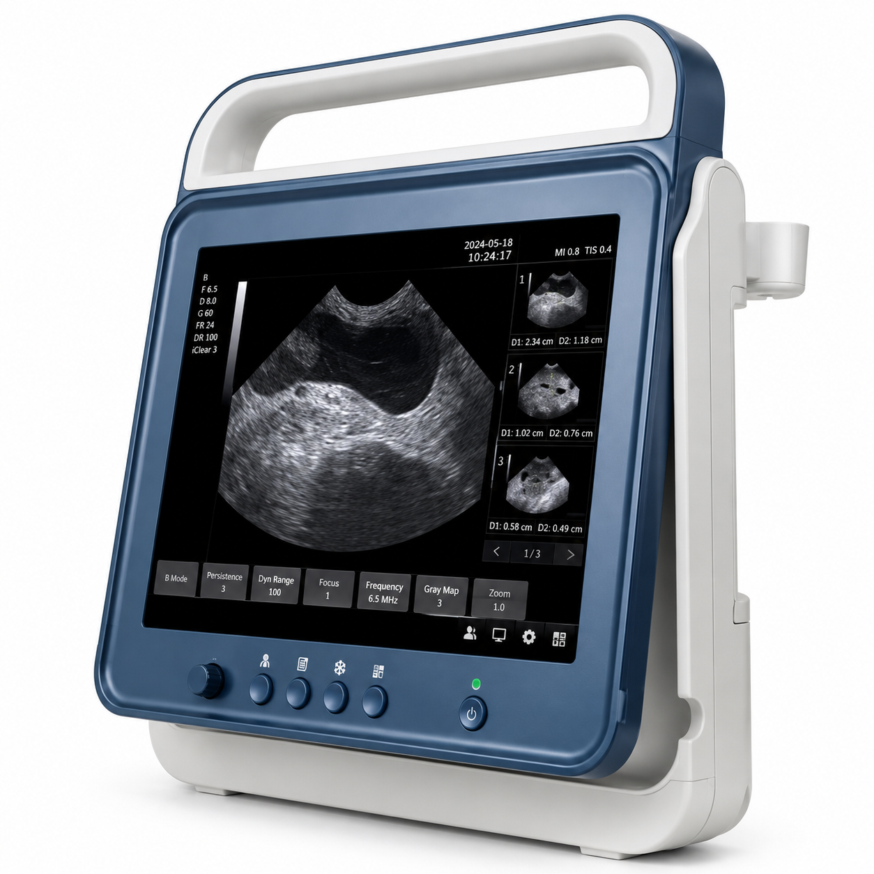 Sistema Scanner Ultrassom Preto e Branco Touch - MSLVU40 Vet