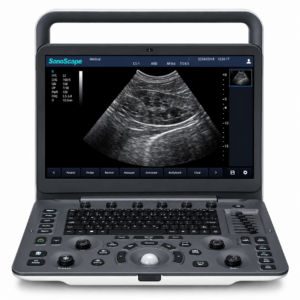 Ultrassom Veterinário Sonoscape E1V