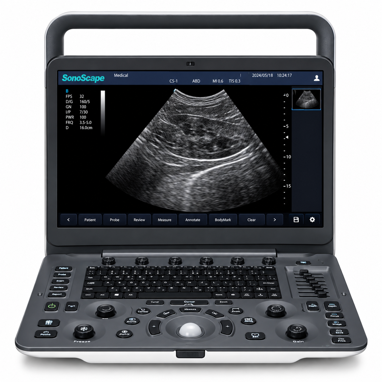 Ultrassom Veterinário Sonoscape E1V