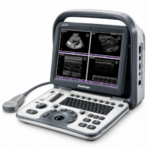 Ultrassom Veterinário Sonoscape A6 Vet - Função Chroma, Bateria