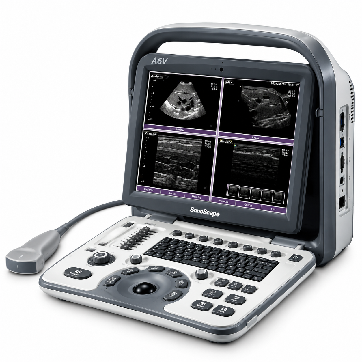Ultrassom Veterinário Sonoscape A6 Vet - Função Chroma, Bateria
