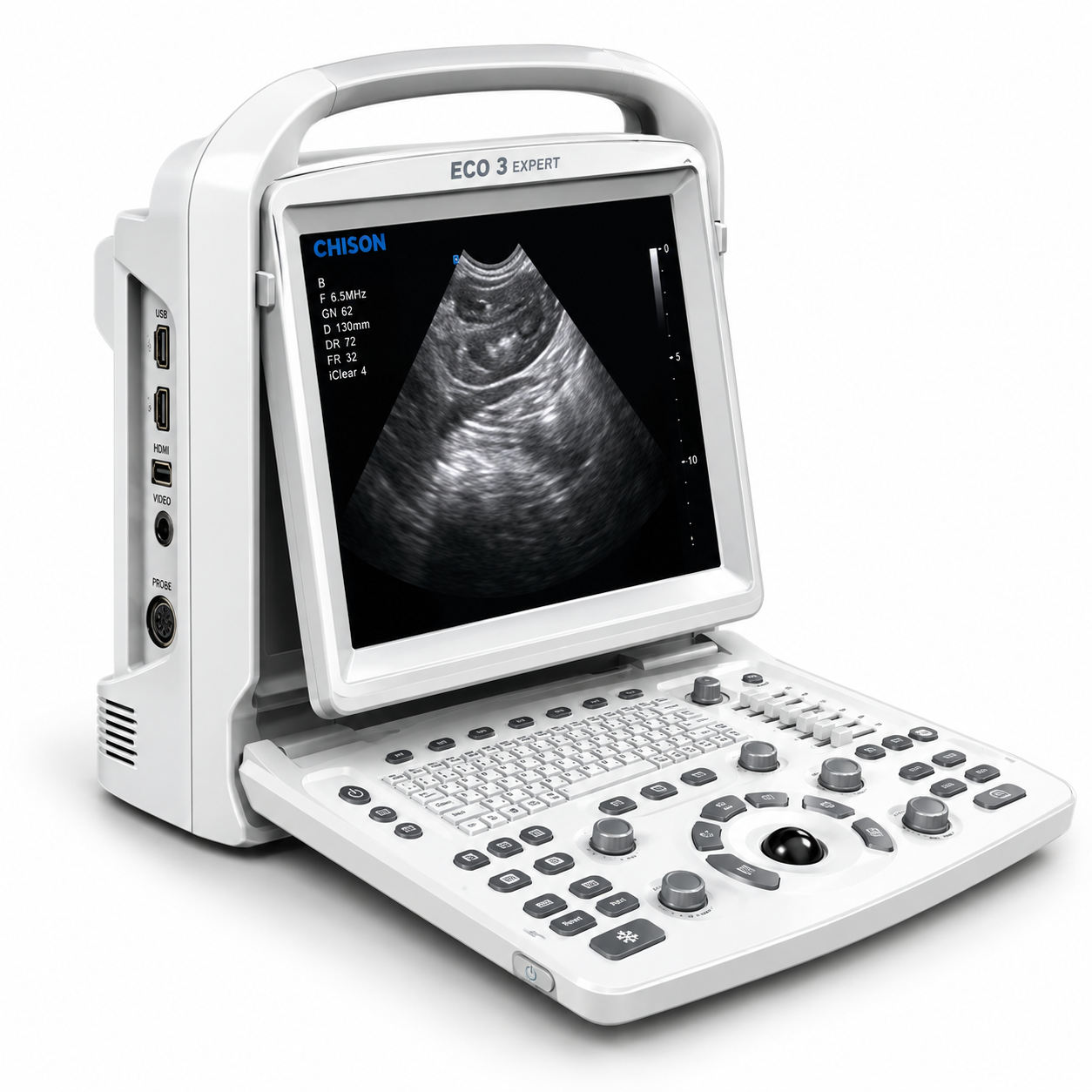 Ultrassom Veterinário ECO3 Expert Chison