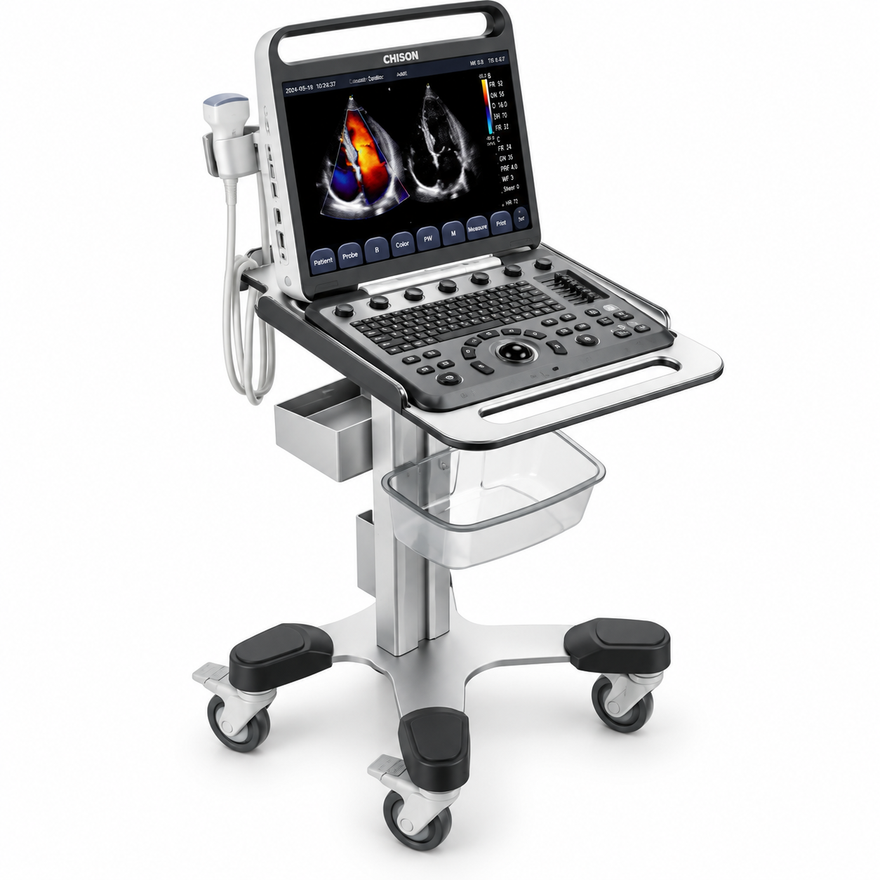Ultrassom Veterinário Chison SonoVET 8 – Doppler Colorido Cardíaco e Multiuso - Imagem 4