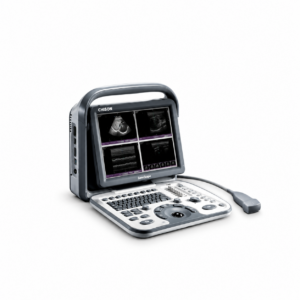 Aparelho Ultrassom Veterinário Sonoscape A5 Vet - LCD 12, USB, Bateria