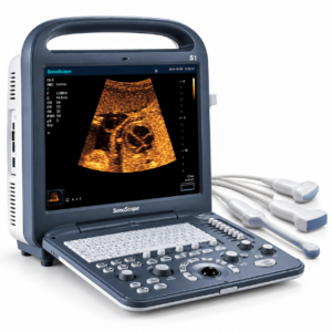 Ultrassom Veterinário Sonoscape S2 Vet -LCD 15, USB, Bateria, D