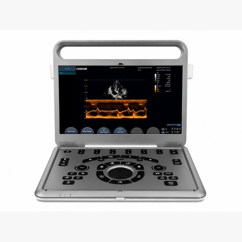 Ultrassom Veterinário Chison SonoVET 8 – Doppler Colorido Cardíaco e Multiuso